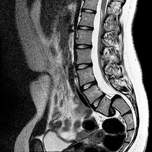medico especialista en columna vertebral Moron San Miguel Villa Lynch