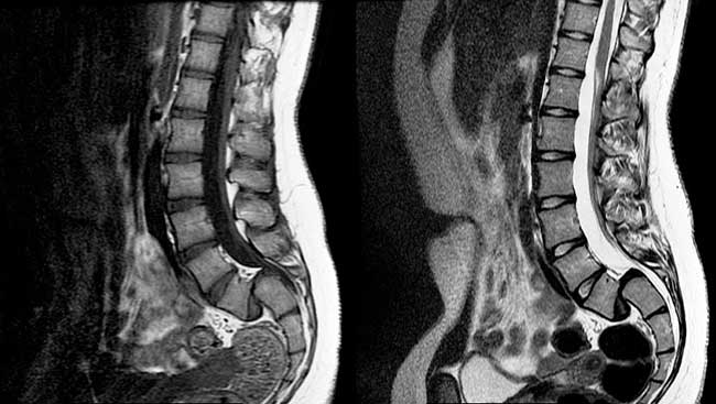 medicos cirujanos especialistas en estenosis lumbar zona oeste