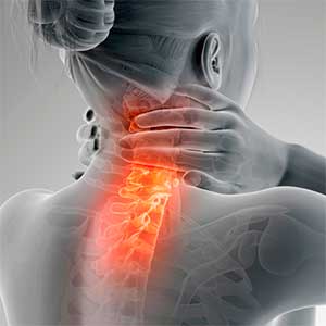 Hernia de Disco Cervical Medico especialista Zona Oeste