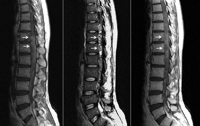 cirujano especialista en infecciones en columna vertebral zona oeste