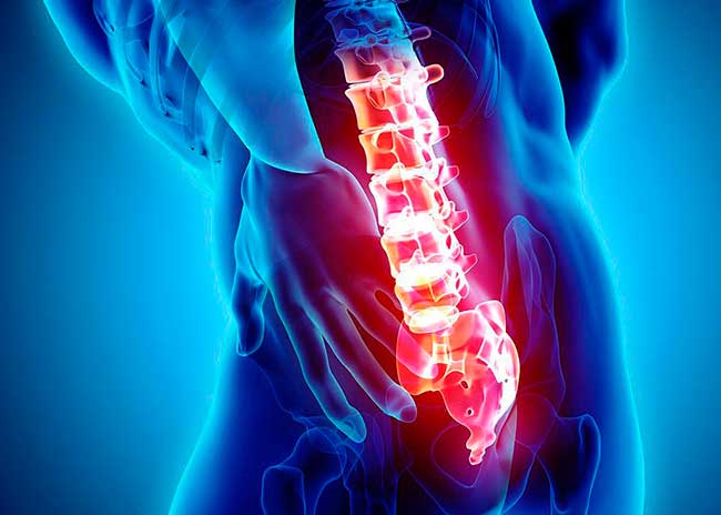 medicos cirujanos especialistas en estenosis lumbar zona oeste